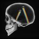 Axwell & Ingrosso vs. Alesso vs. Underworld - Dreamer (ANGEMI, Rudeejay, Da Brozz & Keengs Bootleg)