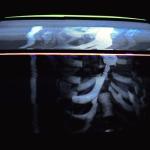 album image BlastZone CARCASS