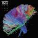 Muse - Panic Station